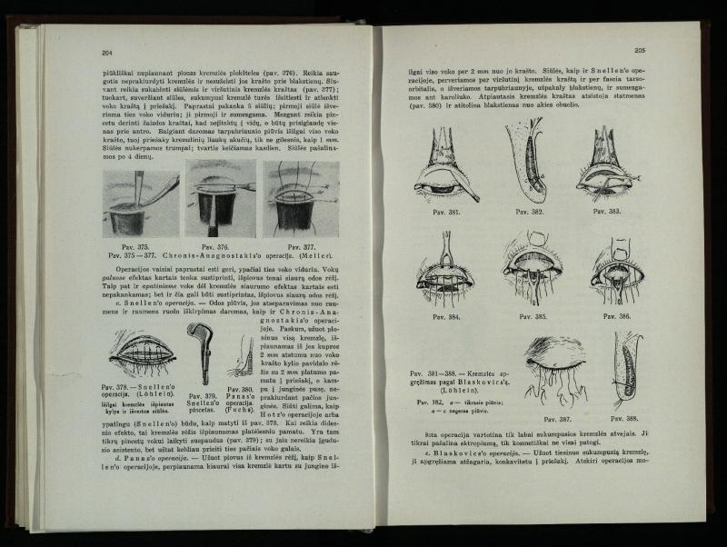 Akių ligų vadovas / Petras Avižonis. – Kaunas: Medicinos fakultetao leidinys, 1940. – VIII, 841, [2] p., 18 iliustr. lap.
