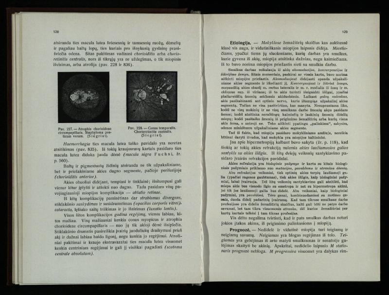 Akių ligų vadovas / Petras Avižonis. – Kaunas: Medicinos fakultetao leidinys, 1940. – VIII, 841, [2] p., 18 iliustr. lap.