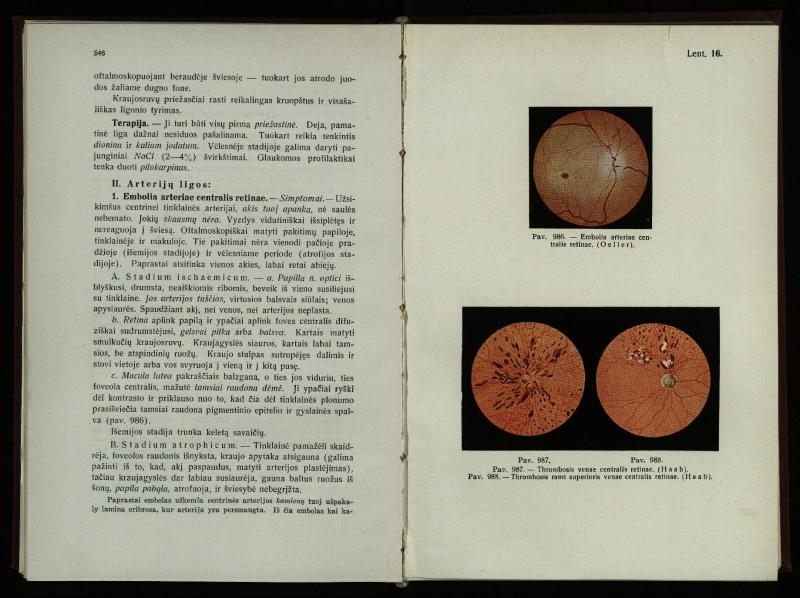 Akių ligų vadovas / Petras Avižonis. – Kaunas: Medicinos fakultetao leidinys, 1940. – VIII, 841, [2] p., 18 iliustr. lap.