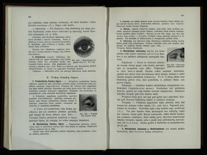 Akių ligų vadovas / Petras Avižonis. – Kaunas: Medicinos fakultetao leidinys, 1940. – VIII, 841, [2] p., 18 iliustr. lap.