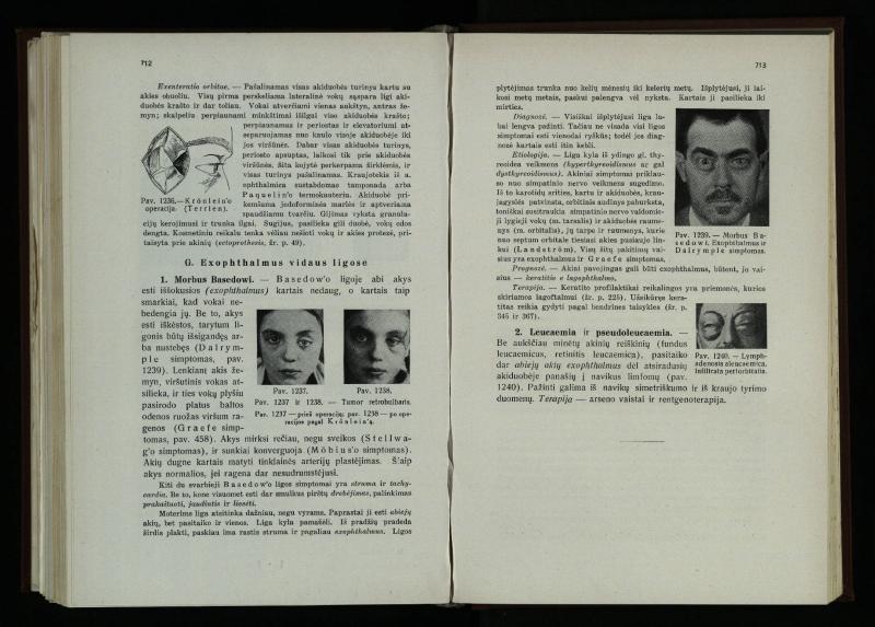 Akių ligų vadovas / Petras Avižonis. – Kaunas: Medicinos fakultetao leidinys, 1940. – VIII, 841, [2] p., 18 iliustr. lap.