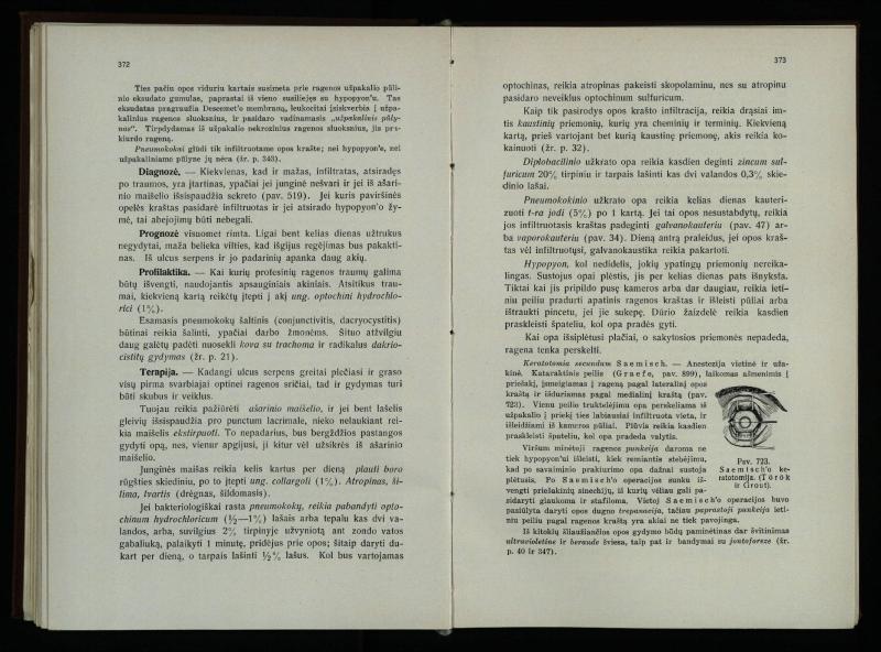 Akių ligų vadovas / Petras Avižonis. – Kaunas: Medicinos fakultetao leidinys, 1940. – VIII, 841, [2] p., 18 iliustr. lap.