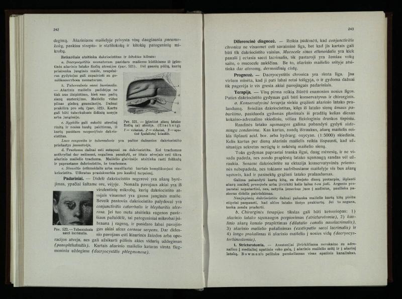 Akių ligų vadovas / Petras Avižonis. – Kaunas: Medicinos fakultetao leidinys, 1940. – VIII, 841, [2] p., 18 iliustr. lap.