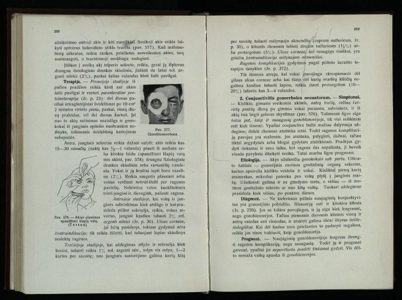 Akių ligų vadovas / Petras Avižonis. – Kaunas: Medicinos fakultetao leidinys, 1940. – VIII, 841, [2] p., 18 iliustr. lap.