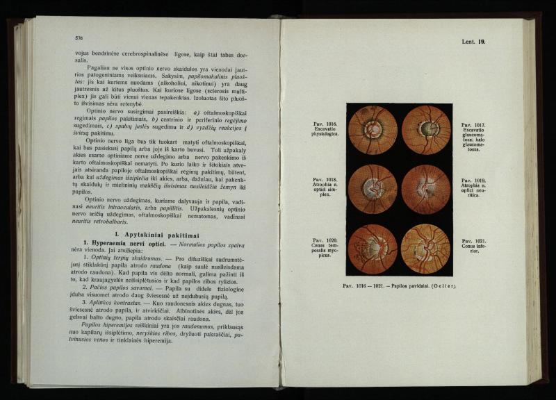 Akių ligų vadovas / Petras Avižonis. – Kaunas: Medicinos fakultetao leidinys, 1940. – VIII, 841, [2] p., 18 iliustr. lap.