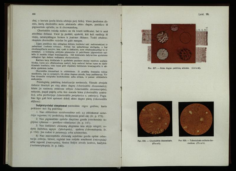 Akių ligų vadovas / Petras Avižonis. – Kaunas: Medicinos fakultetao leidinys, 1940. – VIII, 841, [2] p., 18 iliustr. lap.